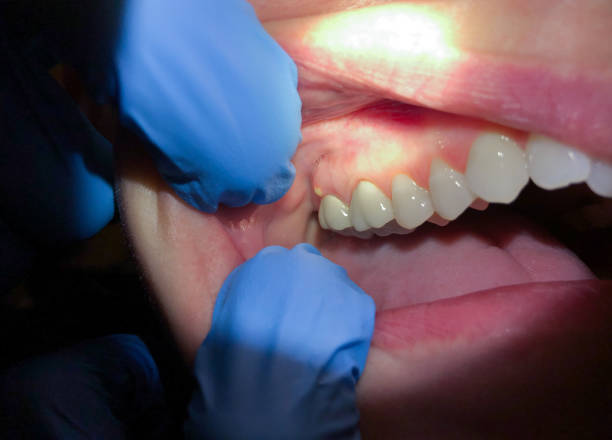 Emergency Dentist Open Today in MO